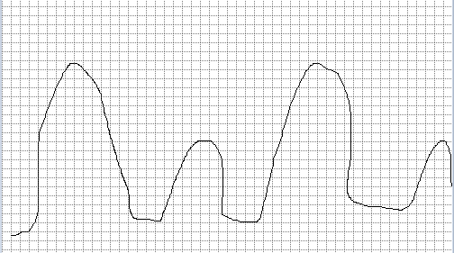 f96b805c9ce382d0fbd6386601aa7e4